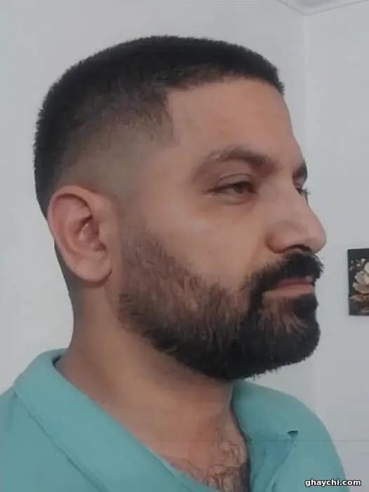 نمونه کار موی سر — اصلاح مو قبل و بعد مردانه در ازگل، تهران — محمد طلادار