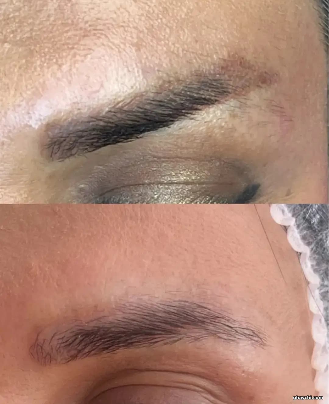 نمونه کار آرایش دائم — ریمووال زنانه در سعادت آباد، تهران — حوری داراب