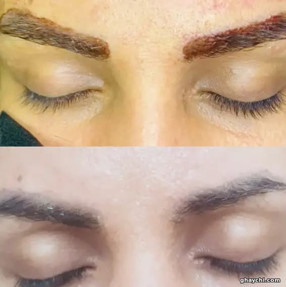نمونه کار آرایش دائم — ریمووال زنانه در کرج، کرج — آمن موسوی