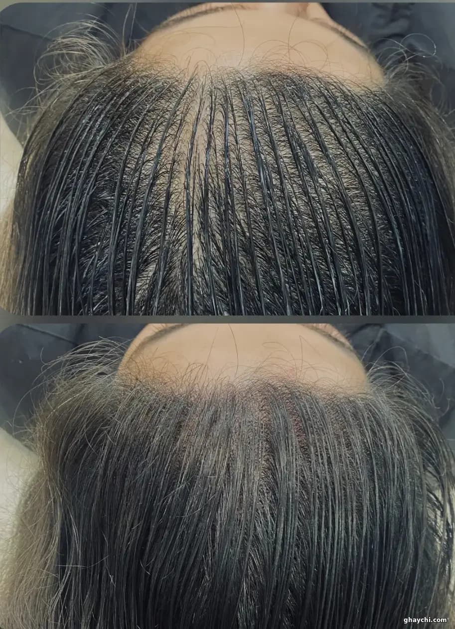 نمونه کار آرایش دائم — آرایش دائم بدن و صورت زنانه در سعادت آباد، تهران — حوری داراب