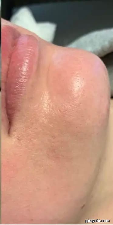 نمونه کار پوست — فیشیال صورت قبل و بعد زنانه در شیراز، شیراز — آزیتا مردانی