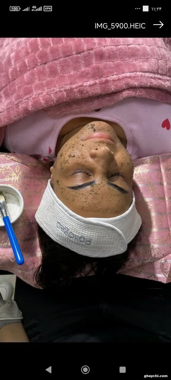 نمونه کار پوست — لایه برداری زنانه در قشم، قشم — مرضیه باغبانی