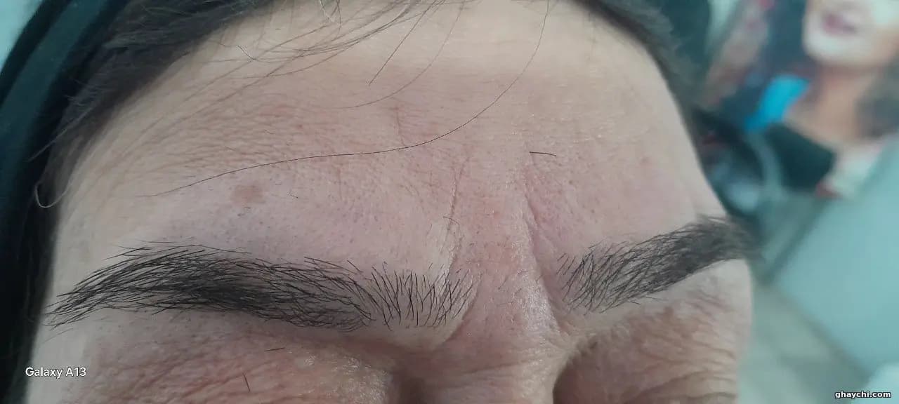 نمونه کار پوست — اصلاح و وکس صورت زنانه در کامیاران، کامیاران — ارزو پویا