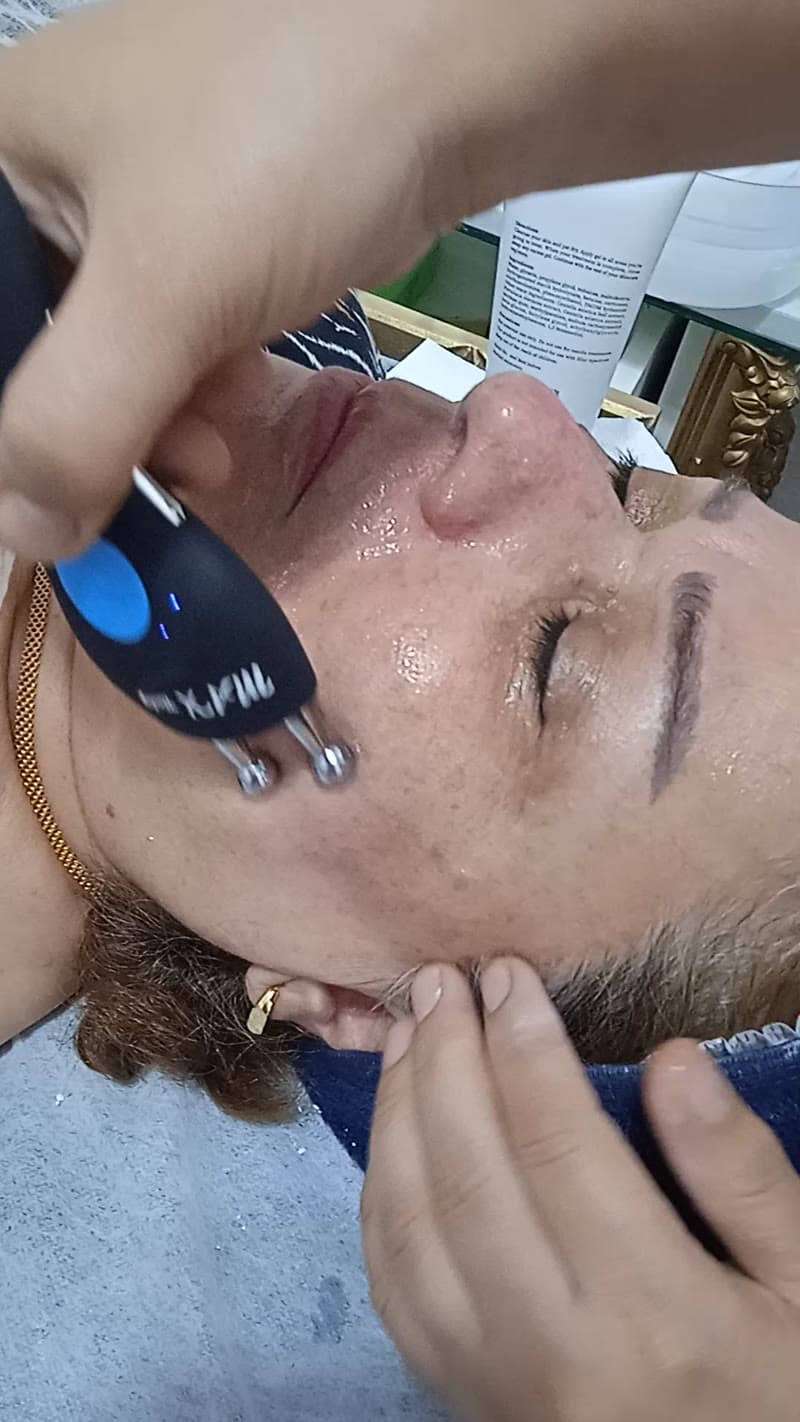 نمونه کار پوست — کلاژن سازی ویدئو زنانه در رشت، رشت — سکینه رجبی مقدم