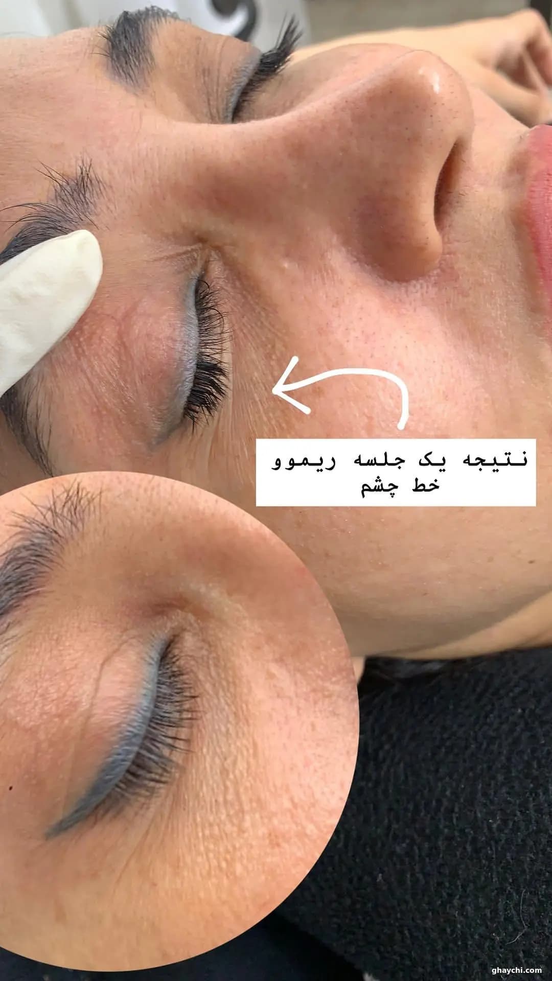نمونه کار آرایش دائم — ریمووال زنانه در بلوار فرامرز عباسی، مشهد — اعظم عشقی