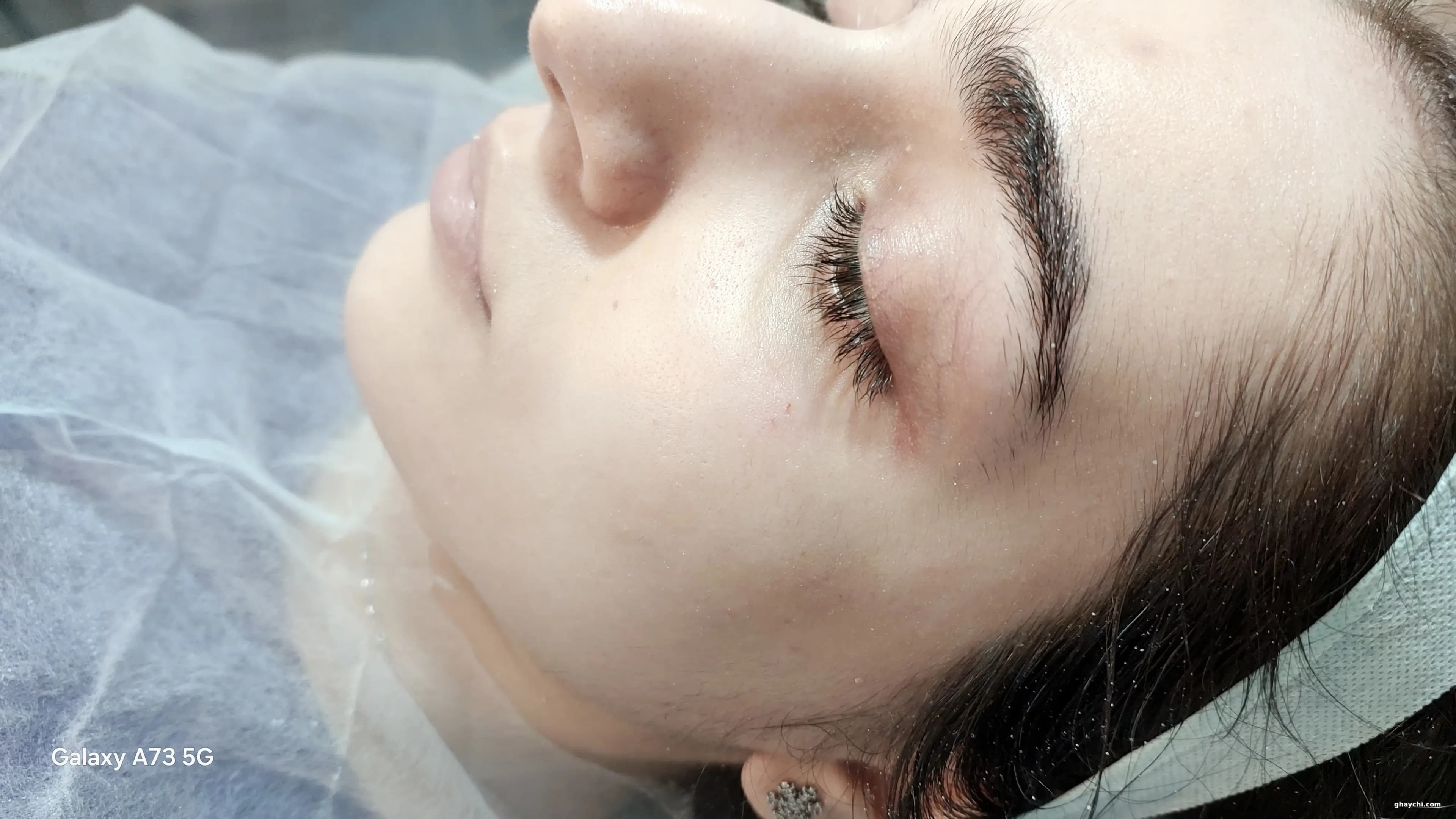 نمونه کار پوست — فیشیال صورت قبل و بعد زنانه در خیابان مدرس، اصفهان — کاتالیابیوتی اصفهان