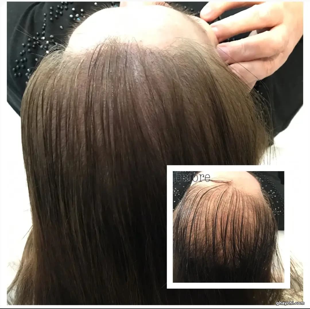 نمونه کار آرایش دائم — آرایش دائم بدن و صورت زنانه در سعادت آباد، تهران — حوری داراب