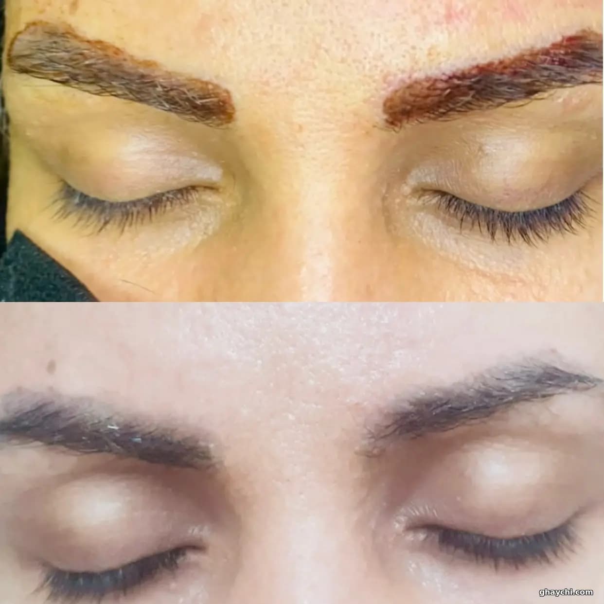 نمونه کار آرایش دائم — ریمووال قبل و بعد زنانه در کرج، کرج — آمن موسوی