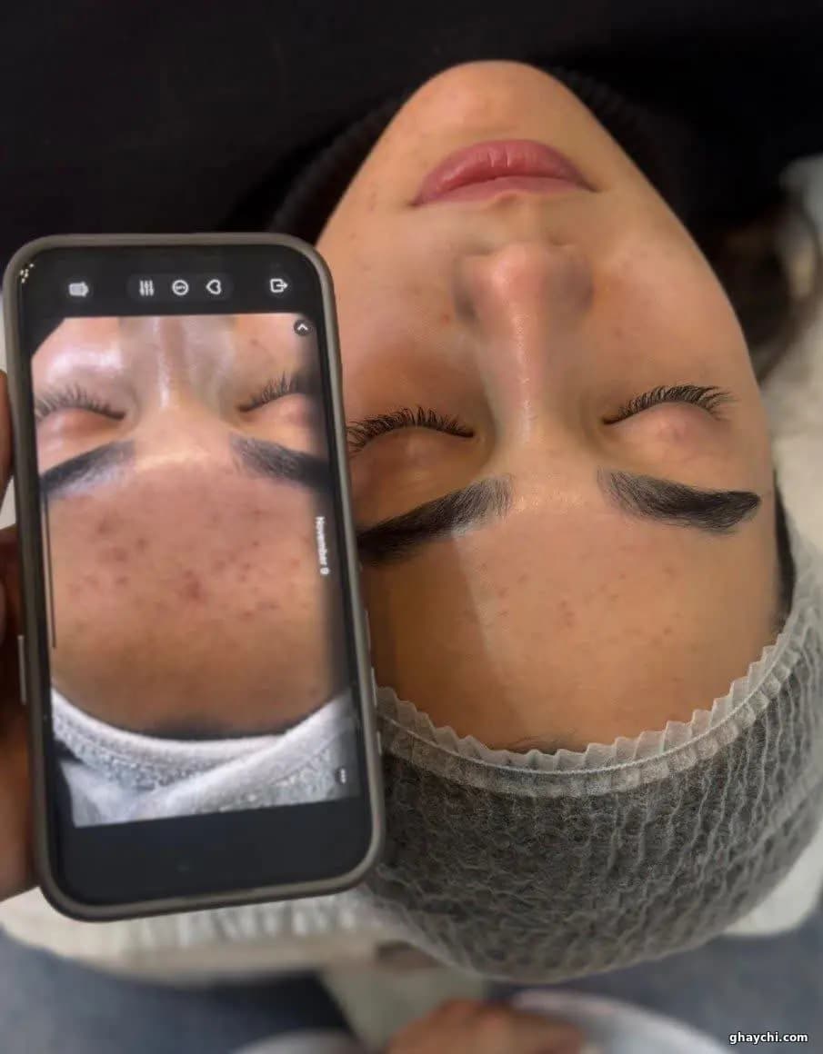نمونه کار پوست — فیشیال صورت زنانه در بلوار سجاد، مشهد — سارا عمرانی