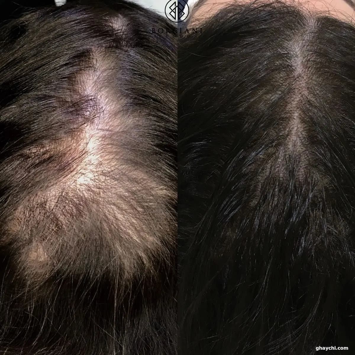 نمونه کار آرایش دائم — میکروپیگمنتیشن زنانه در بلوار امامت، مشهد — الهه الا