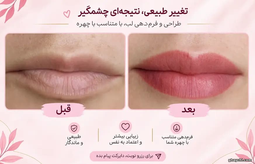 نمونه کار آرایش دائم — شیدینگ لب زنانه در کرمانشاه، کرمانشاه — کیانا رسول نژادی