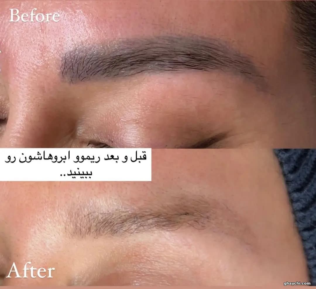 نمونه کار آرایش دائم — ریمووال زنانه در سعادت آباد، تهران — حوری داراب