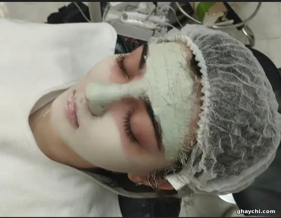 نمونه کار پوست — فیشیال صورت زنانه در تبریز، تبریز — میترا گوهرشناس