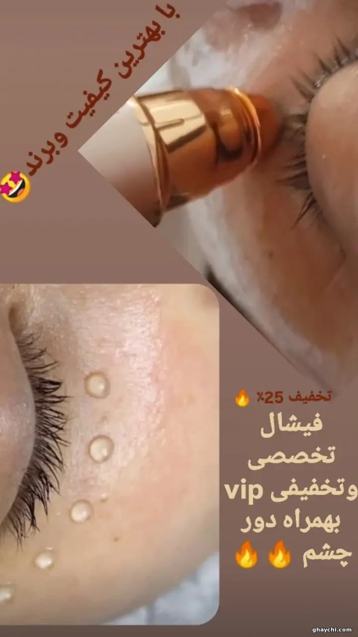 تخفیف پکیج تخصصی تخفیفی vipبهمراه دورچشم در رشت، رشت — سکینه رجبی مقدم