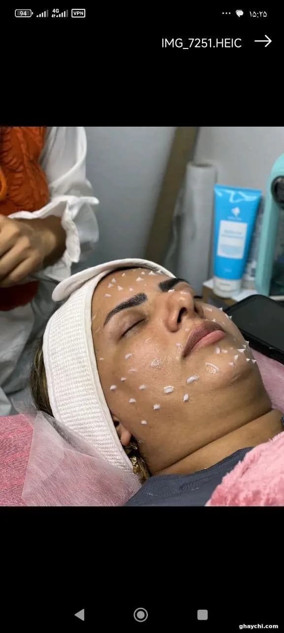 نمونه کار پوست — فیشیال صورت زنانه در قشم، قشم — مرضیه باغبانی