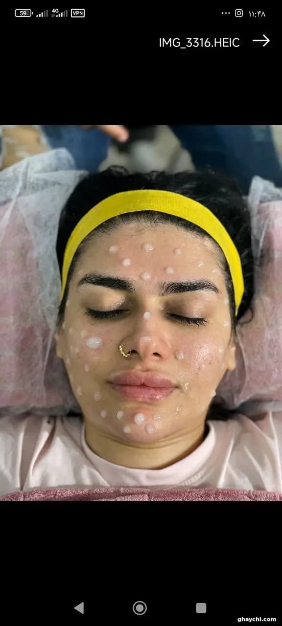 نمونه کار پوست — فیشیال صورت زنانه در قشم، قشم — مرضیه باغبانی