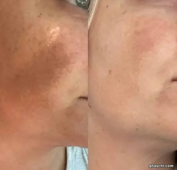 نمونه کار پوست — فیشیال صورت زنانه در بلوار سجاد، مشهد — سارا عمرانی