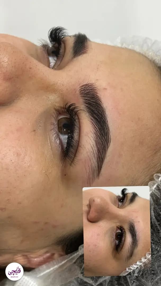 نمونه کار آرایش دائم — آرایش دائم بدن و صورت قبل و بعد زنانه در خیابان ملاصدرا، شیراز — حدیث فروزنده