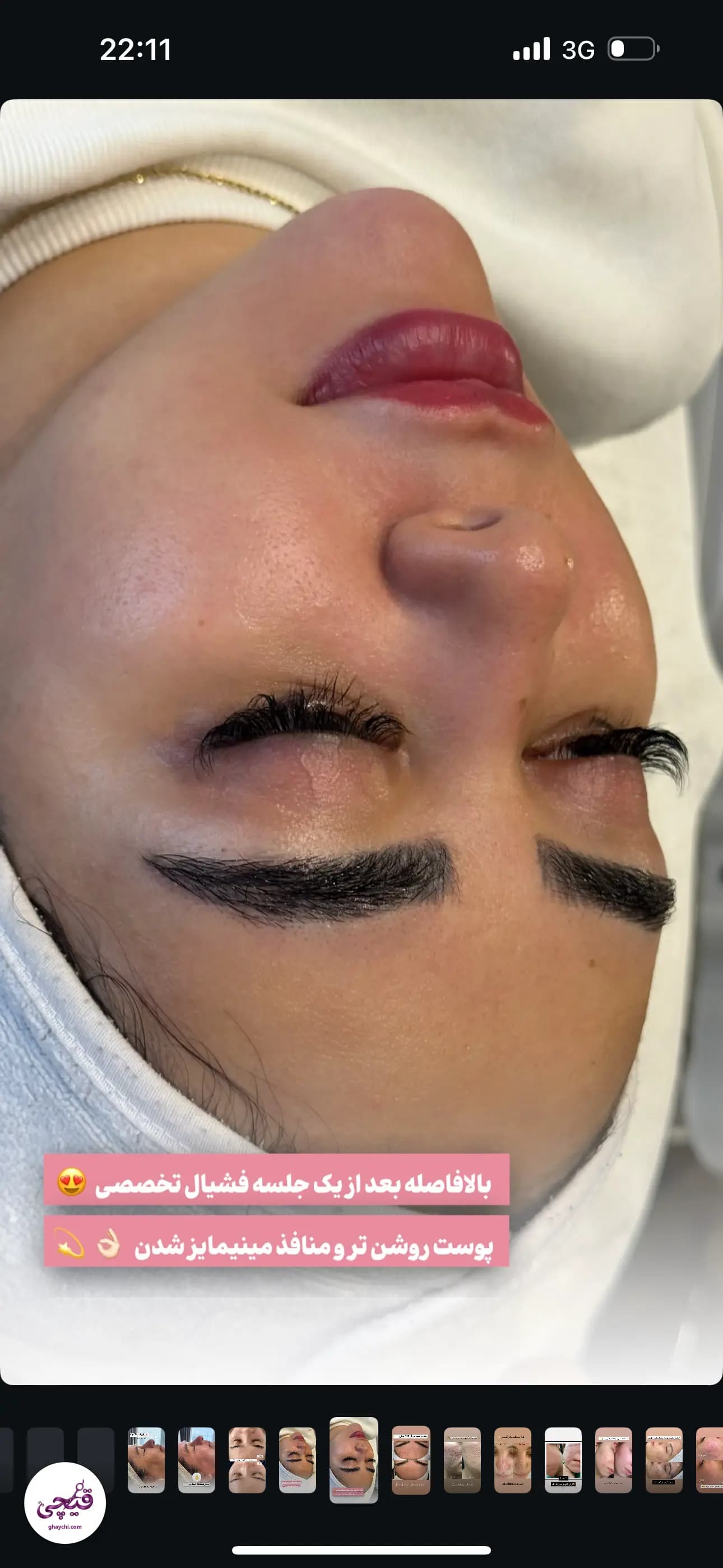 نمونه کار پوست — فیشیال صورت قبل و بعد زنانه در فرهنگ شهر، شیراز — مریم اسکین کر