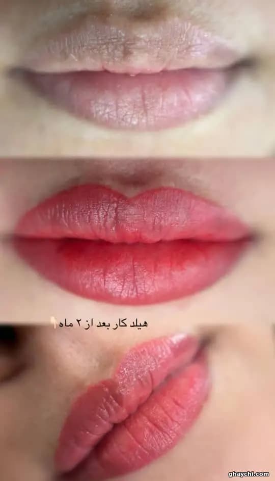 نمونه کار آرایش دائم — رژ لب دائم قبل و بعد زنانه در افسریه، تهران — لیلی قاسمی