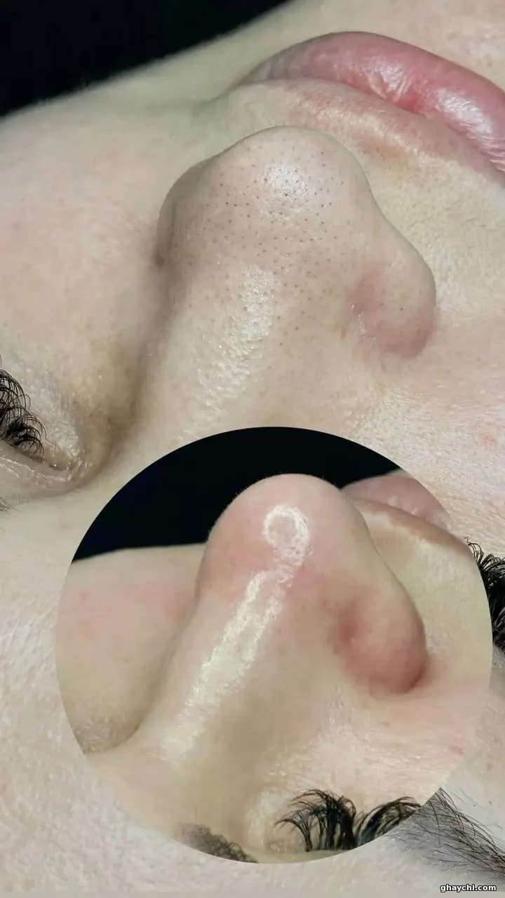 نمونه کار پوست — پاکسازی صورت زنانه در رشت، رشت — الهه ناز