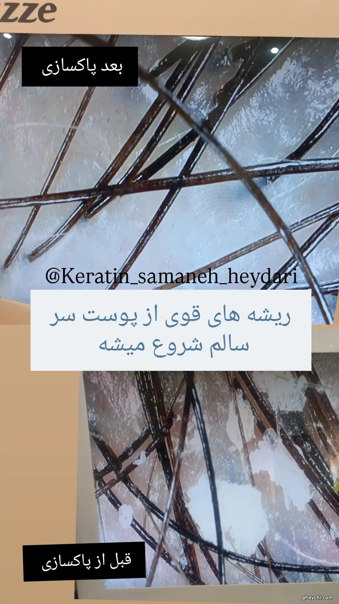 نمونه کار مو — بوتاکس و احیا مو زنانه در رشت، رشت — سمانه حیدری