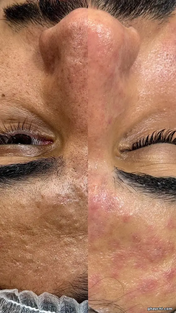 نمونه کار پوست — فیشیال صورت زنانه در سعادت آباد، تهران — سحر رضایی