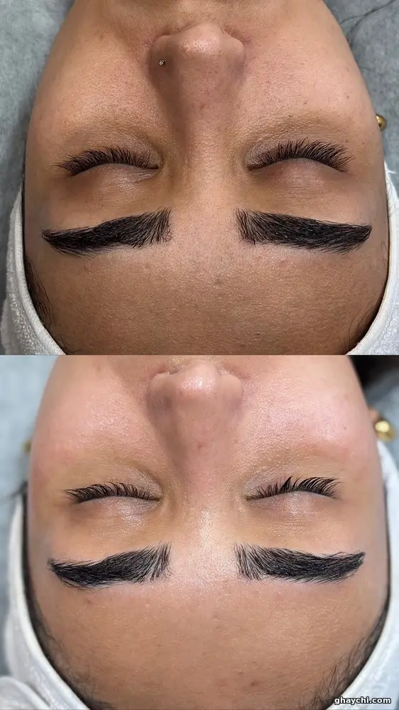 نمونه کار پوست — فیشیال صورت زنانه در سعادت آباد، تهران — سحر رضایی