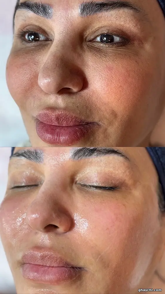 نمونه کار پوست — فیشیال صورت زنانه در سعادت آباد، تهران — سحر رضایی