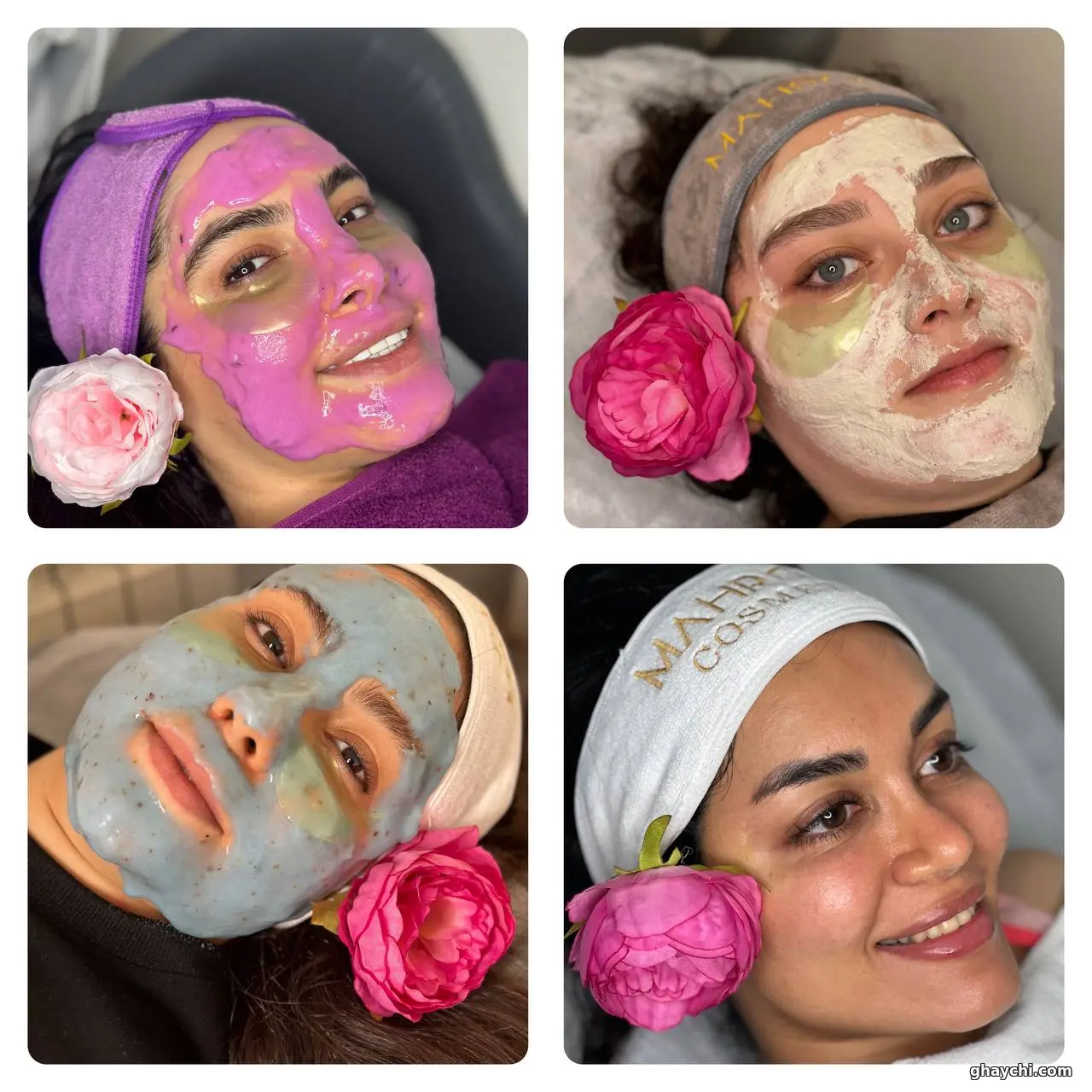 نمونه کار پوست — فیشیال صورت زنانه در نارمک، تهران — محبوبه پروندی
