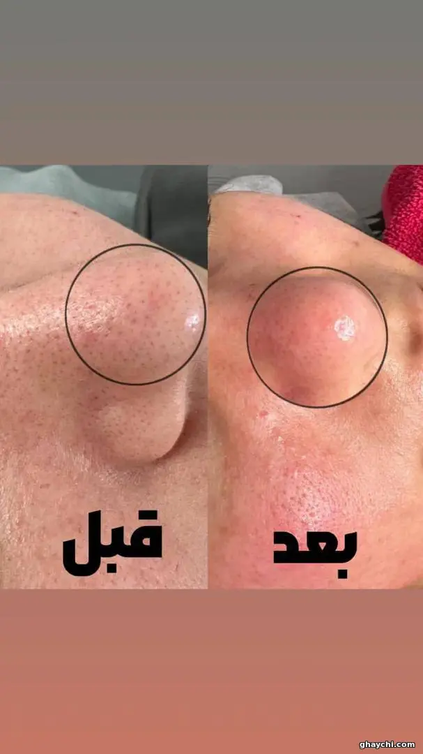نمونه کار پوست — فیشیال صورت زنانه در نارمک، تهران — محبوبه پروندی