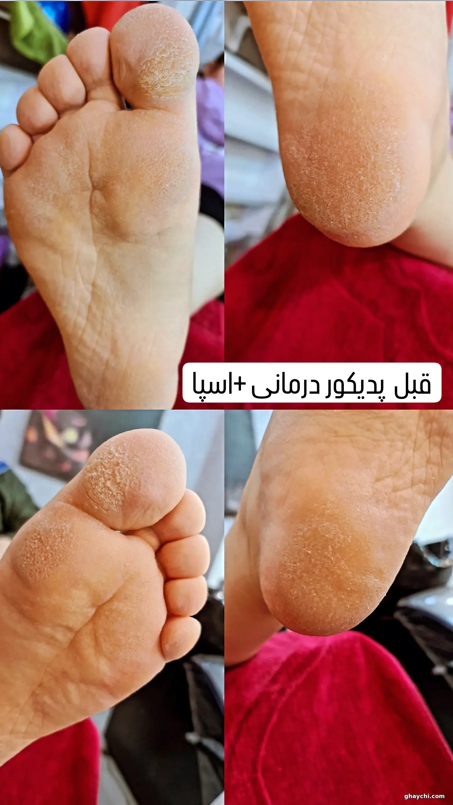 قبل ناخن — کاشت ناخن در افسریه، تهران — معصومه سادات میرحسینی