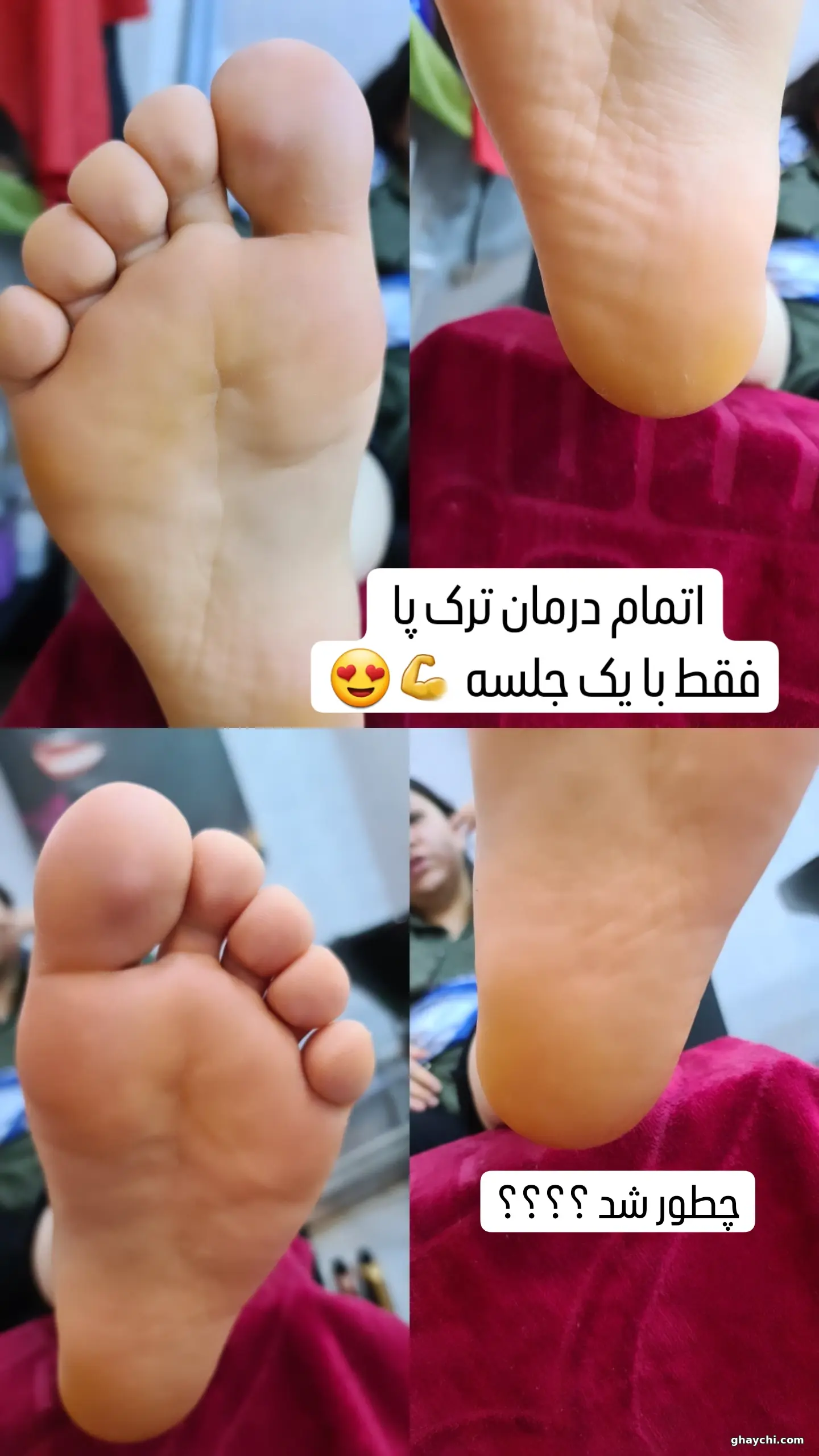 بعد ناخن — کاشت ناخن در افسریه، تهران — معصومه سادات میرحسینی