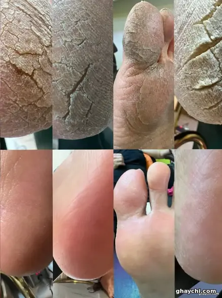 نمونه کار ناخن — کاشت ناخن زنانه در صادقیه، تهران — عروس سرای بانو بهاره چگینی