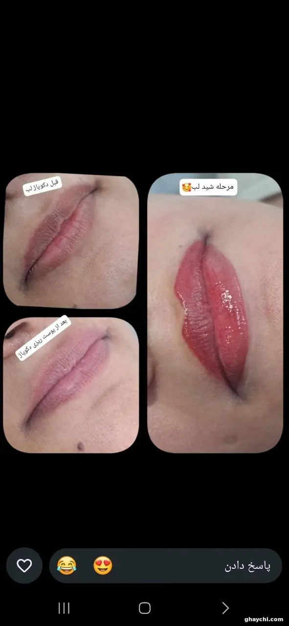 نمونه کار آرایش دائم — شیدینگ لب زنانه در پاداد شهر، اهواز — شیما خلف پور هلاله