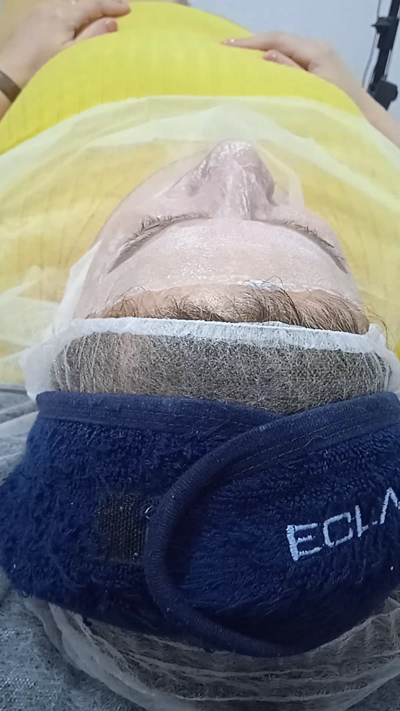 نمونه کار پوست — کلاژن سازی ویدئو زنانه در رشت، رشت — سکینه رجبی مقدم
