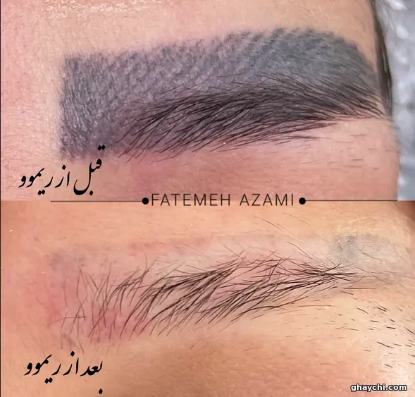 نمونه کار آرایش دائم — میکروبلیدینگ زنانه در ولیعصر، تبریز — فاطمه اعظمی