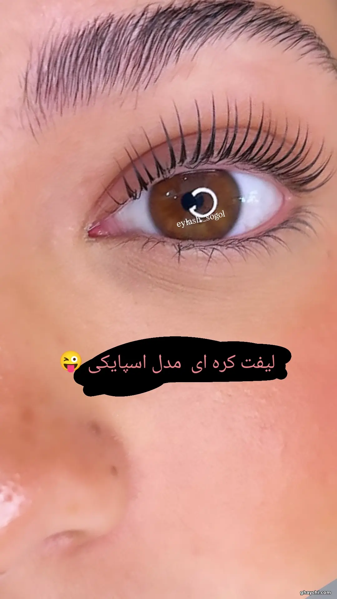 بعد ابرو — لیفت ابرو در هادیشهر، هادیشهر — سوگل مظلومی