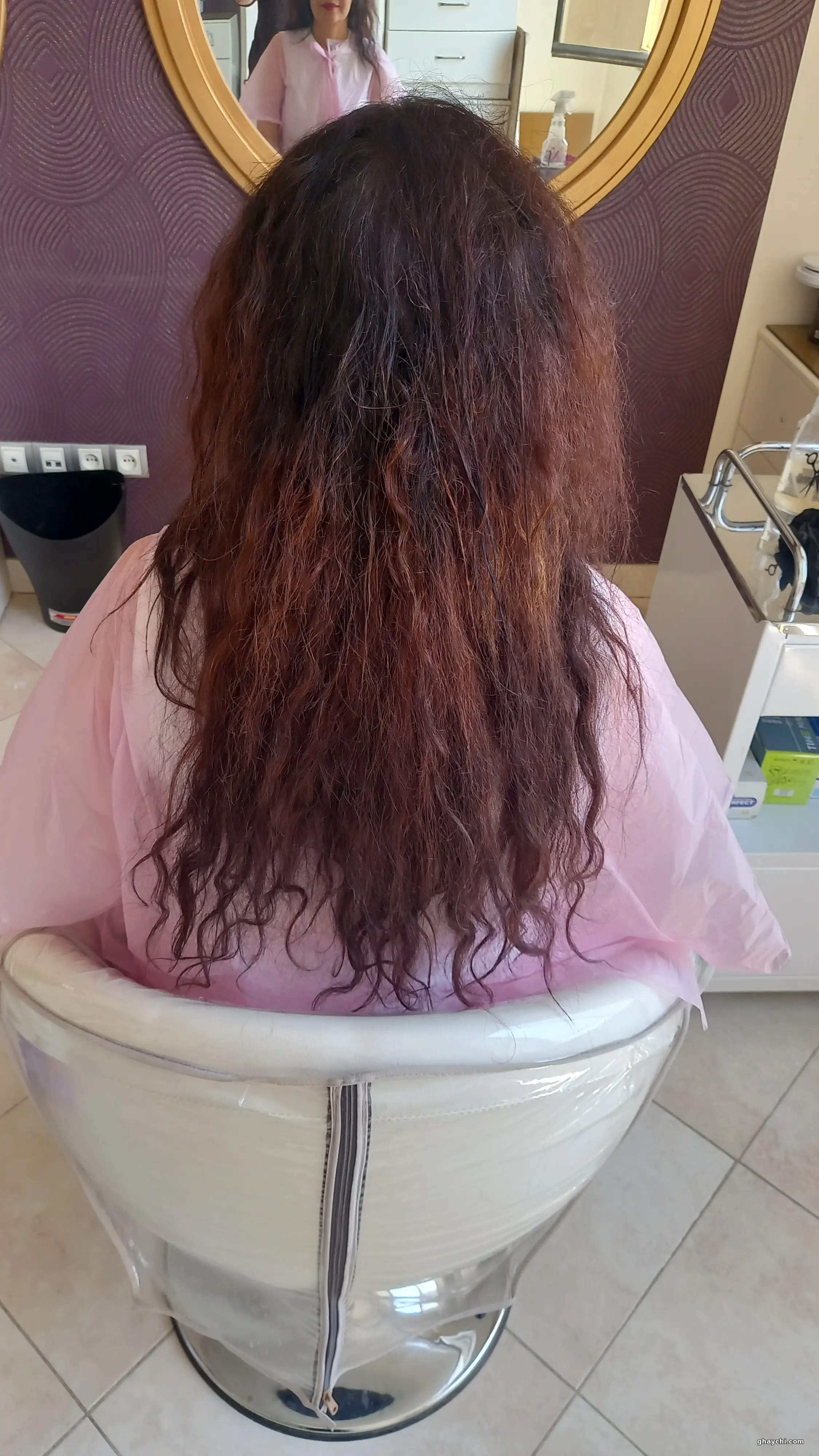 قبل مو — بوتاکس و احیا مو در کرج، کرج — مریم شریفی