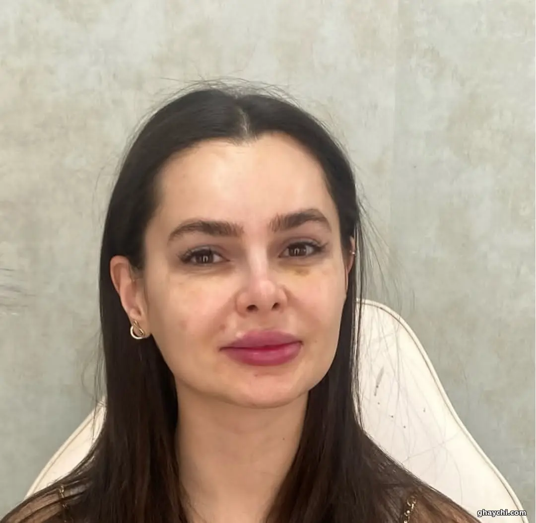 قبل میکاپ — میکاپ لایت در شهرصدرا، شهرصدرا — Sahar بهمن پور