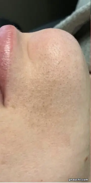 قبل پوست — فیشیال صورت در شیراز، شیراز — آزیتا مردانی
