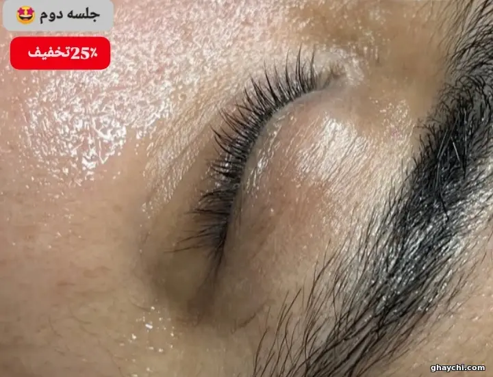 بعد پوست — فیشیال دور چشم در رشت، رشت — سکینه رجبی مقدم