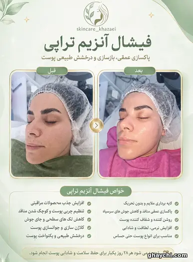 نمونه کار پوست — کلاژن سازی زنانه در کارون شمالی، تهران — زینب خزایی