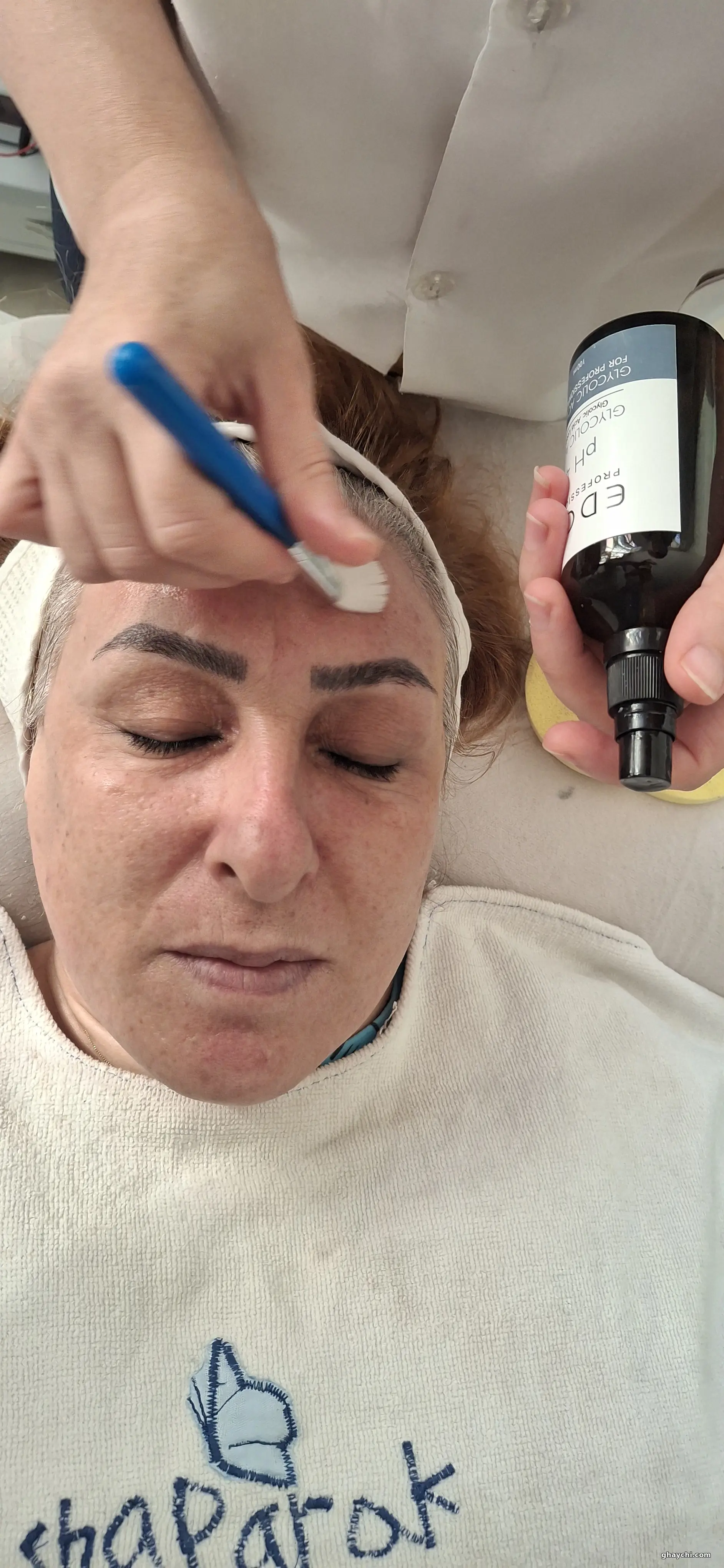 بعد پوست — آبرسانی صورت در اسلامشهر، اسلامشهر — کلینیک گل نرگس