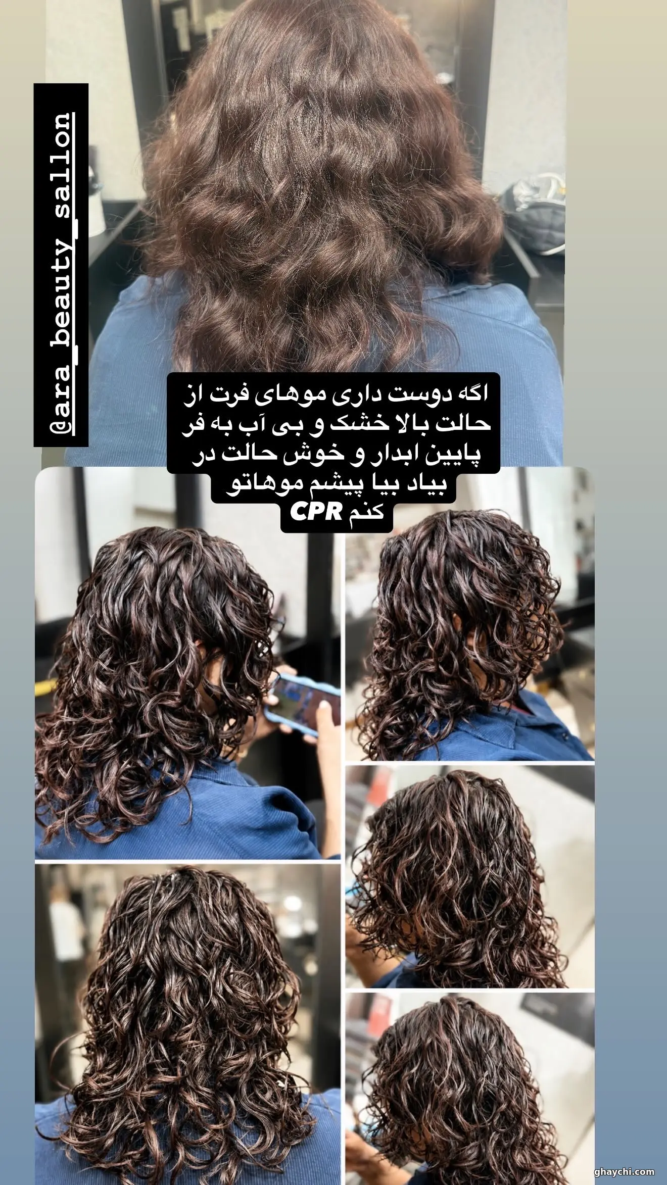 قبل مو — بوتاکس و احیا مو در سمنان، سمنان — الهام امینی