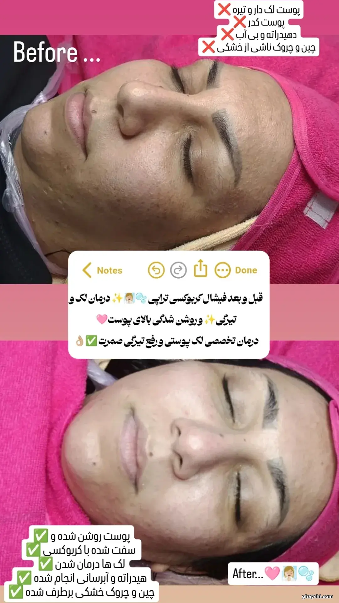 نمونه کار پوست — فیشیال صورت زنانه در کوروش، اهواز — پریسا طالبی بنی