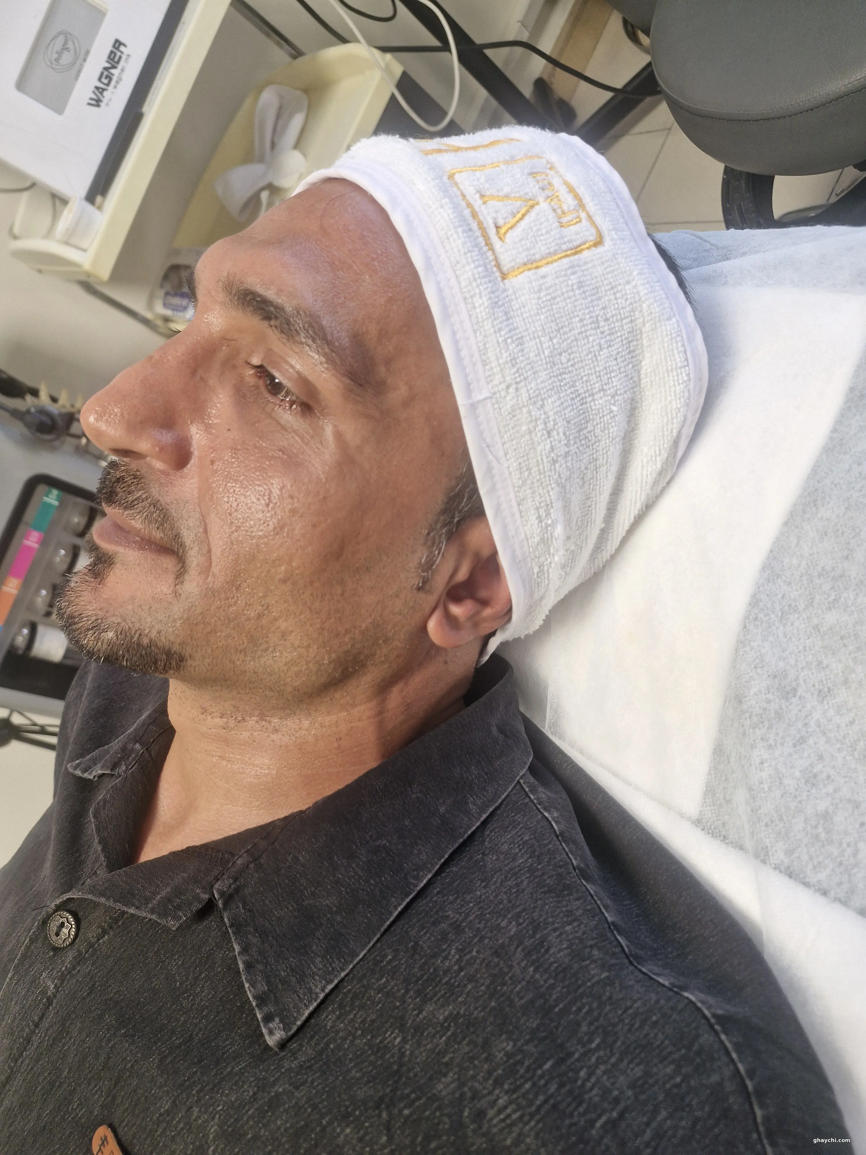 قبل پوست — پاکسازی صورت در یوسف آباد، تهران — شکوفه فروغ نیا