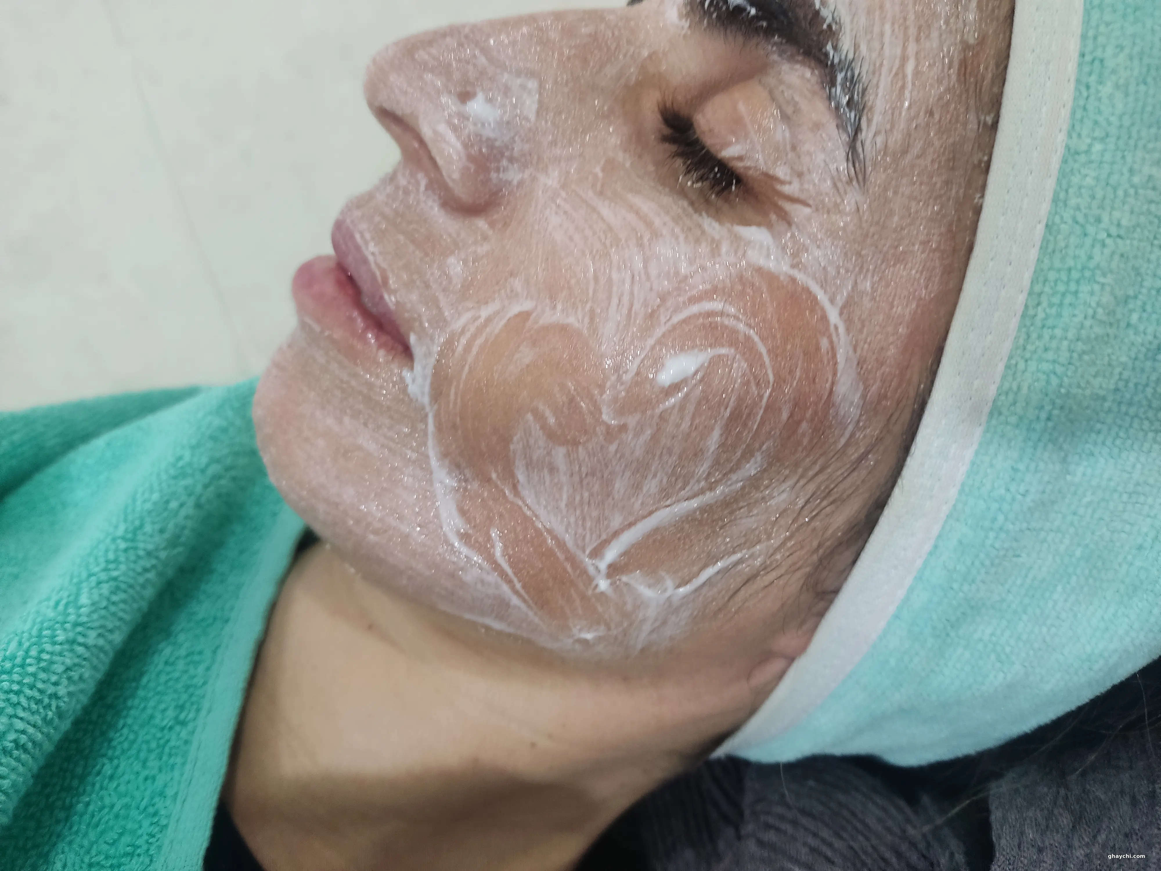 بعد پوست — آبرسانی صورت در  بلوار سفیر، شیراز — مرضیه حیاتی