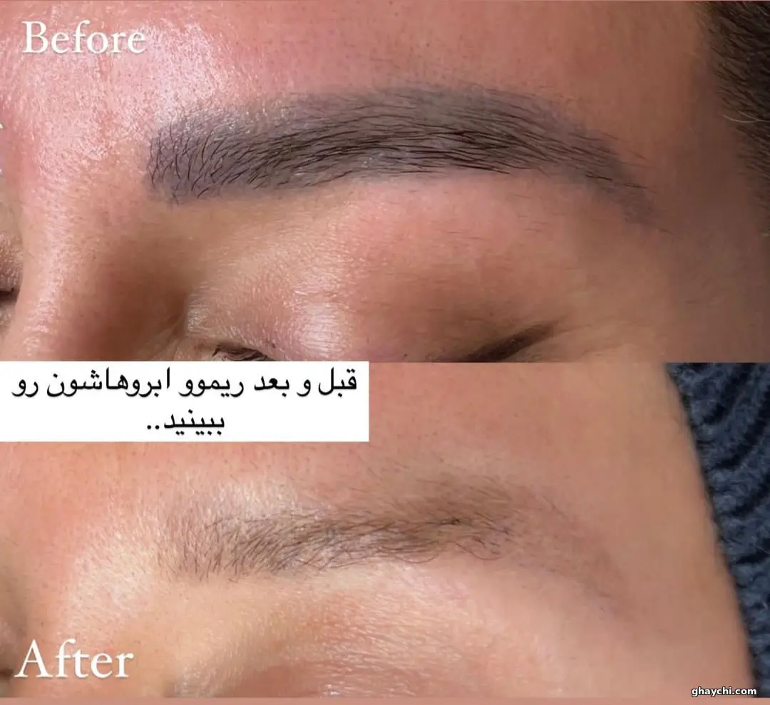 نمونه کار آرایش دائم — ریمووال زنانه در سعادت آباد، تهران — حوری داراب