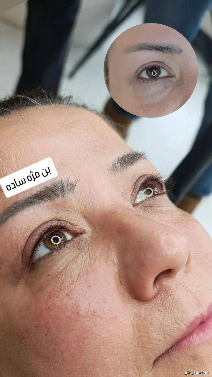 بعد آرایش دائم — بن مژه در سعادت آباد، تهران — حوری داراب